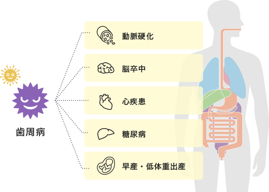 歯周病と全身疾患の関係について イラスト